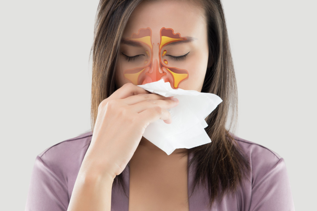 Allergy Management